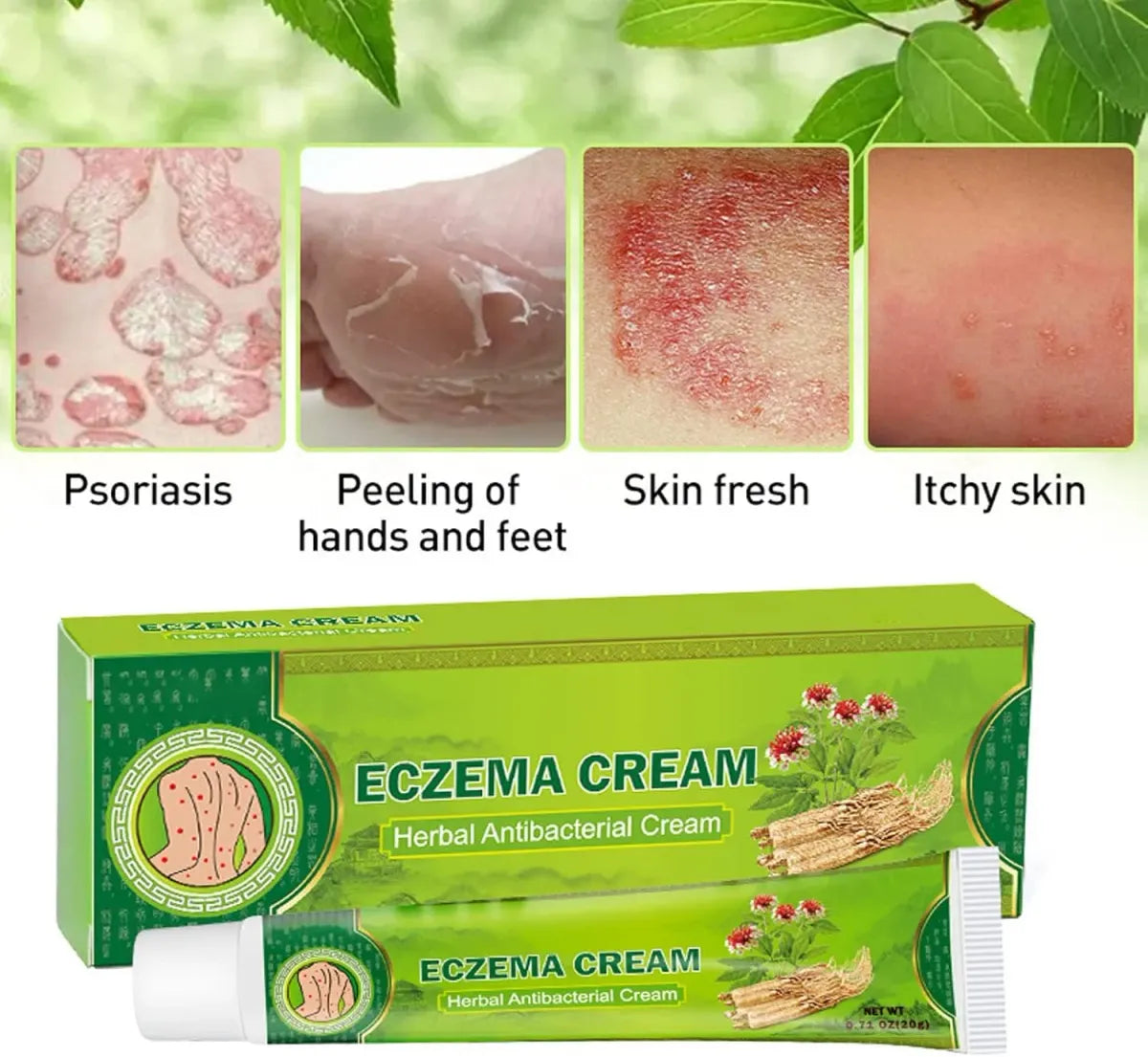 Crème anti-eczéma et antifongique