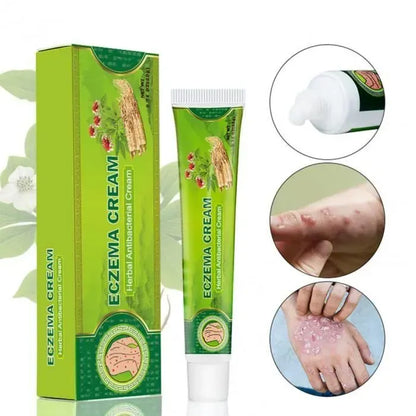 Crème anti-eczéma et antifongique