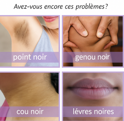 EELHOE Crème Éclaircissante – Luminosité et Soin Intense